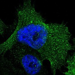 SRPRB Antibody, Novus Biologicals:Antibodies:Primary Antibodies